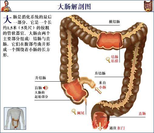 结肠溃疡