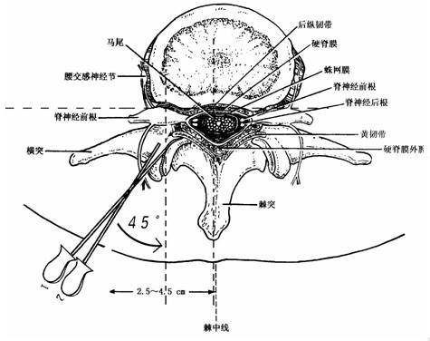 颈肩腰腿疼