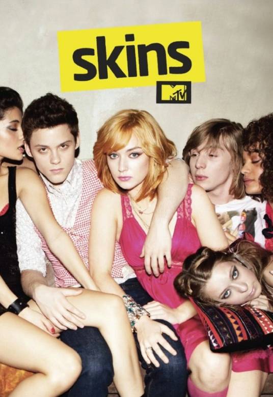 SKINS（2011年翻拍美剧）