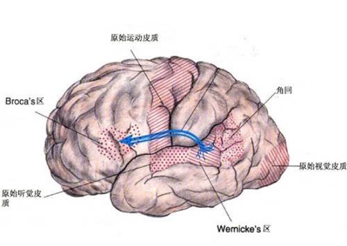 运动性失语症