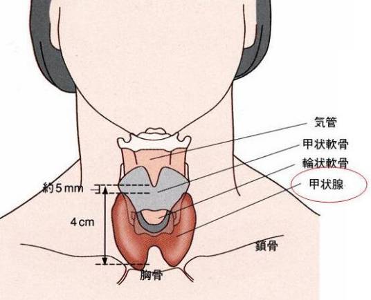 甲状腺切除术