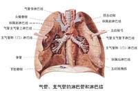 慢性气管炎